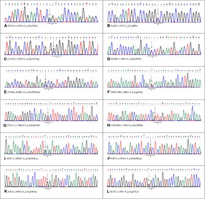 High-Throughput Sequencing to Detect Novel Likely Gene-Disrupting Variants in Pathogenesis of Sporadic Brain Arteriovenous Malformations